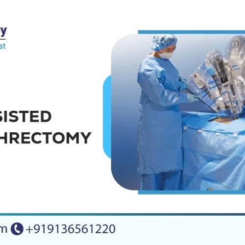partial nephrectomy