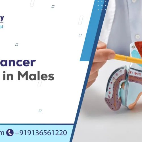 prostate cancer symptoms in males