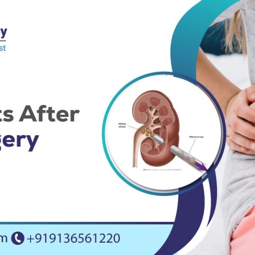 side effects after pcnl surgery