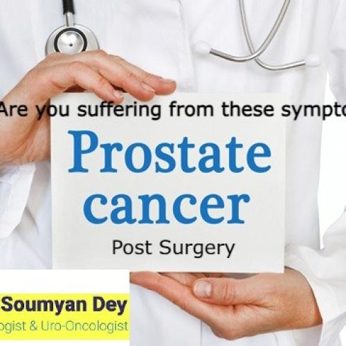 Side Effects of Prostate Cancer Treatment