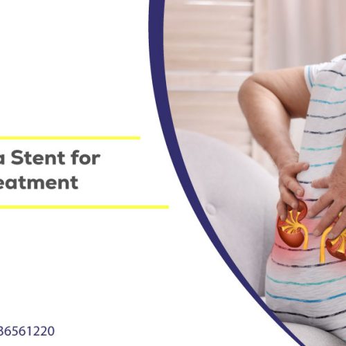 the benefits of a stent for kidney stone treatment