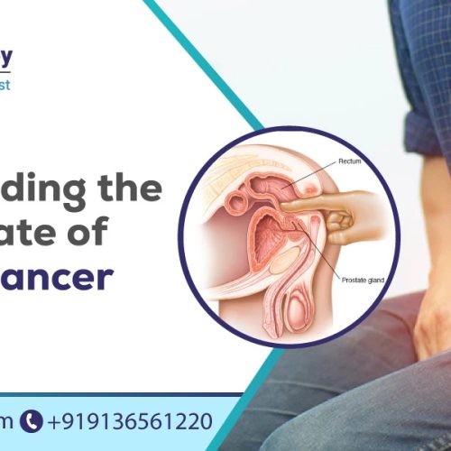 understanding the survival rate of prostate cancer