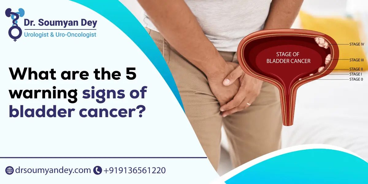 What are the 5 warning signs of bladder cancer