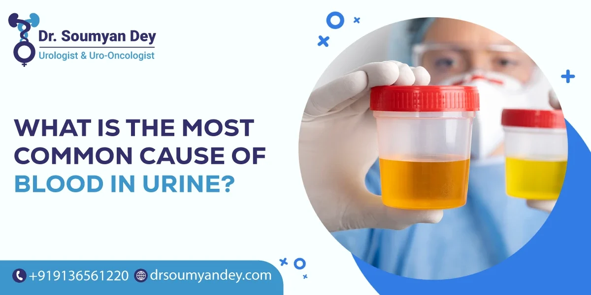 What is the Most Common Cause of Blood in Urine