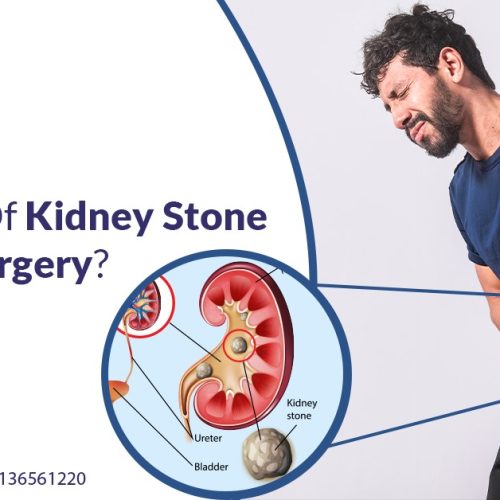 what size of kidney stone requires surgery 