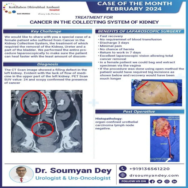 Laparoscopic nephroureterectomy for kidney collecting system cancer by Dr Soumyan Dey